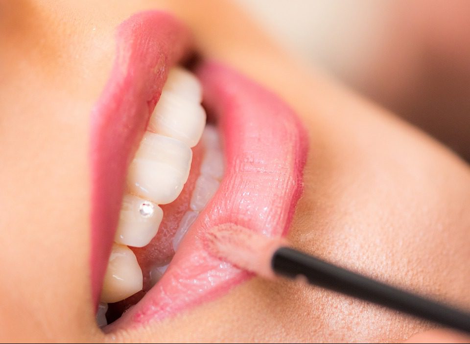 Dental Veneers – Helping in makeover of your teeth!