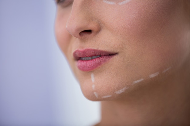 woman-with-marks-drawn-cosmetic-treatment-her-jaw-dental-blog