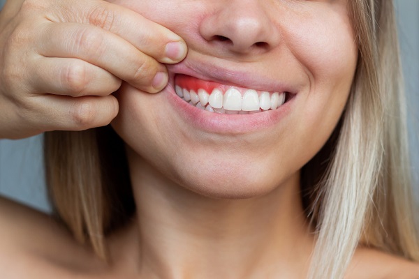 Gum diseases
