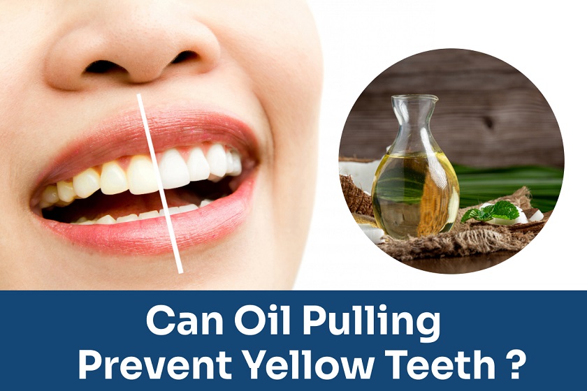 Oil pulling can prevent yellow teeth