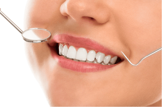 Teeth scaling and polishing