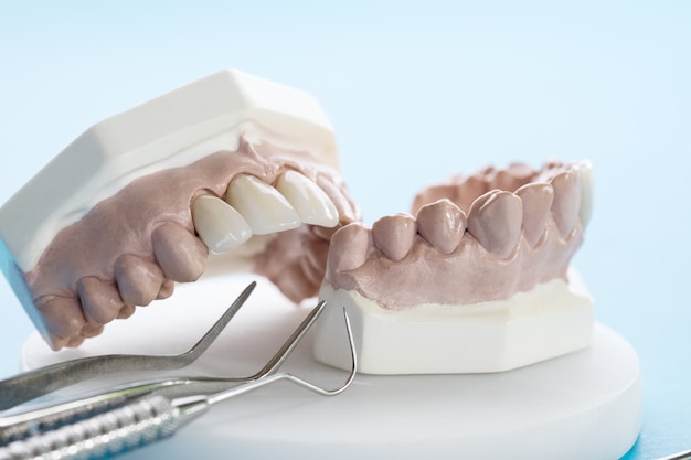 Interdental Cleaning Techniques for Optimal Oral Health