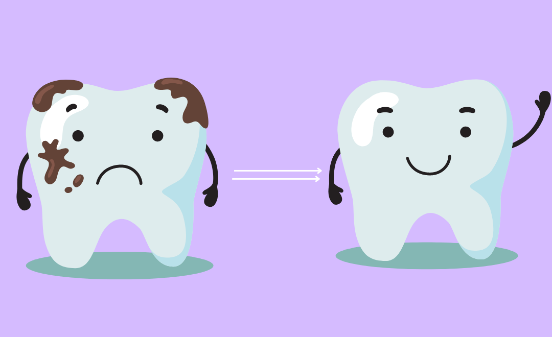 Black stains on teeth